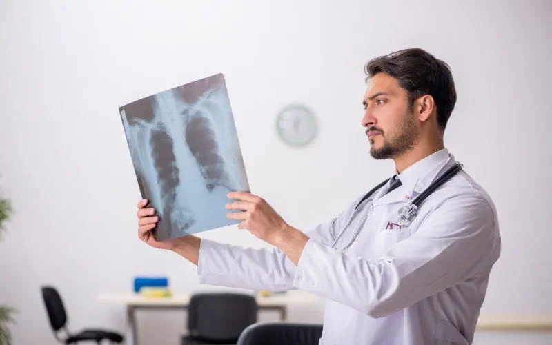 Médecin concentré examinant une radiographie pulmonaire, illustrant l’analyse médicale et le diagnostic en imagerie.